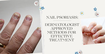 Nail Psoriasis: Dermatologist-Approved Methods for Effective Treatment
