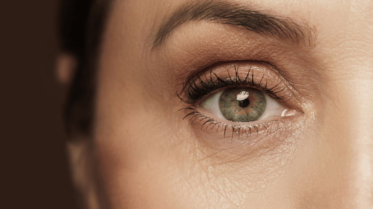 How to Treat Dry Skin Around the Eyes: Doctor's Guide | Clinikally How to Treat Dry Skin Around the Eyes: Doctor's Guide | Clinikally