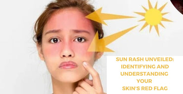 Sun Rash Unveiled: Identifying and Understanding Your Skin's Red Flag