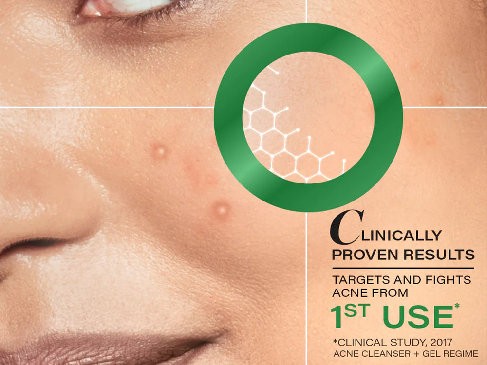 Novology Acne Rescue Spot Corrector Gel