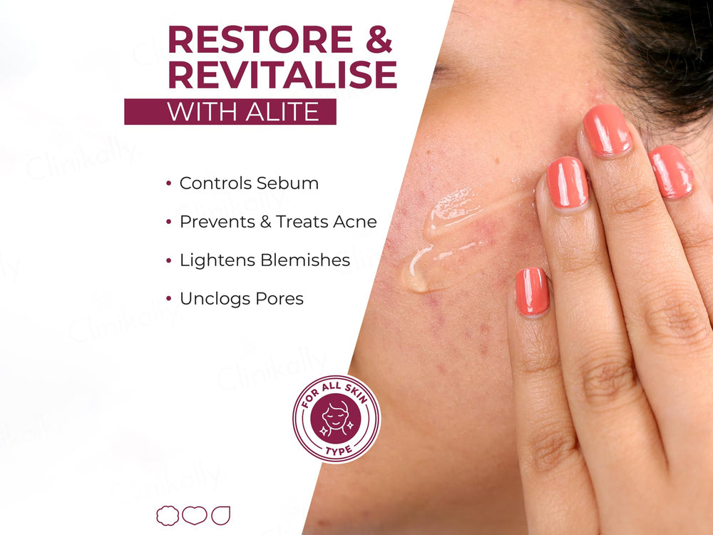Alite Anti Acne Gel
