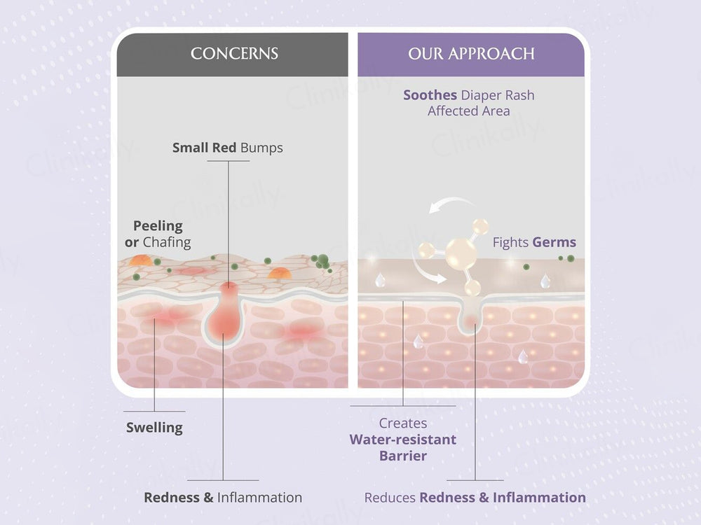 Areoveda Baby Diaper Rash Cream