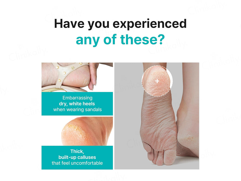 Ariul Smooth & Pure Calming Tea Tree Foot Peeling Mask