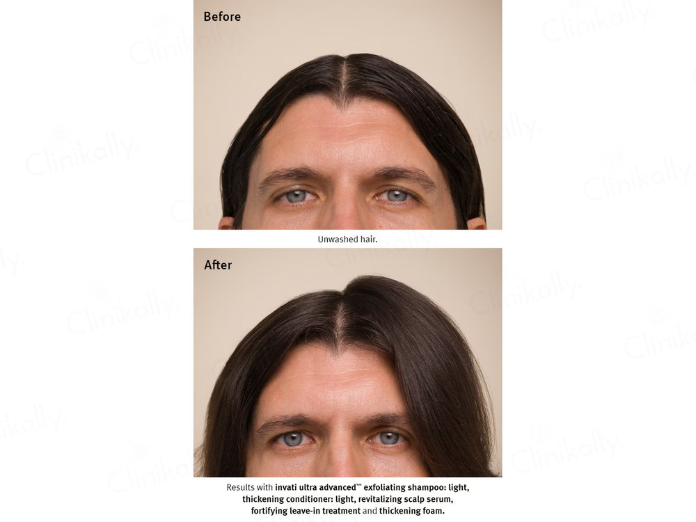 Aveda Invati Ultra Advanced Exfoliating Shampoo For Thinning Hair