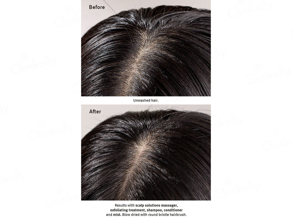 Aveda Scalp Solutions Exfoliating Scalp Treatment