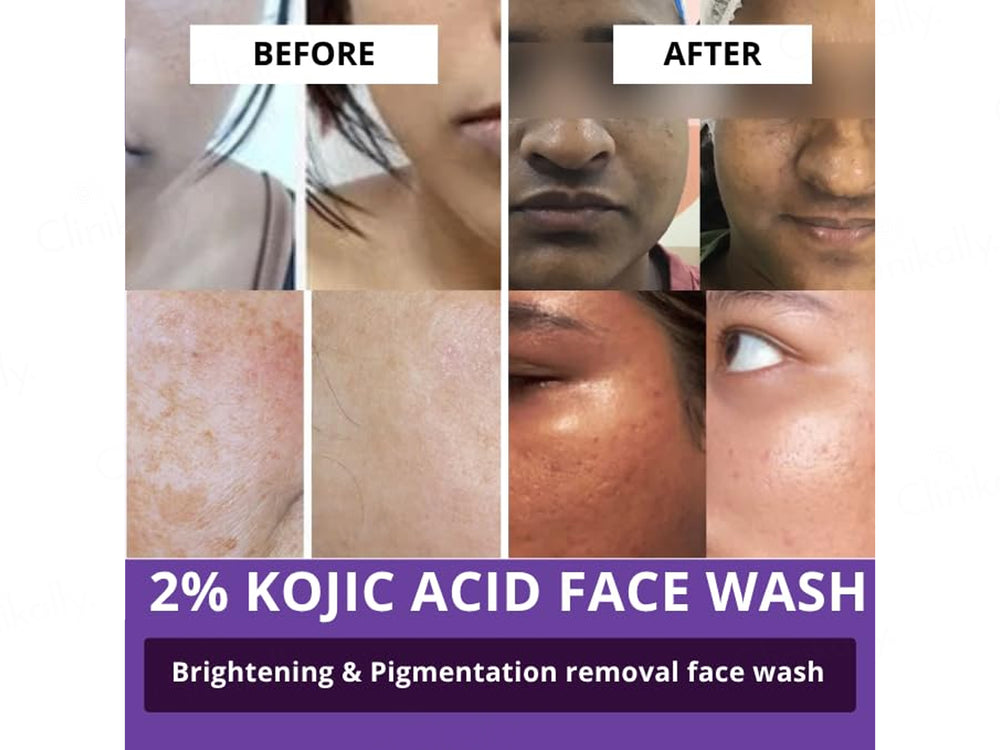 Bake 2% Kojic Acid + Alpha Arbutin Facewash