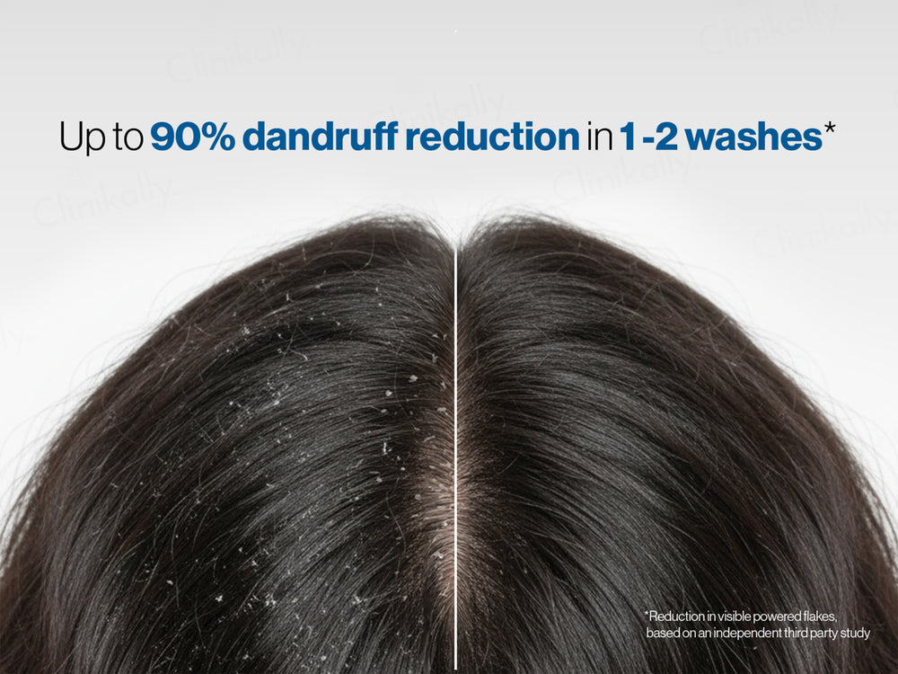 Be Bodywise 1% Ketoconazole Dandruff Shampoo
