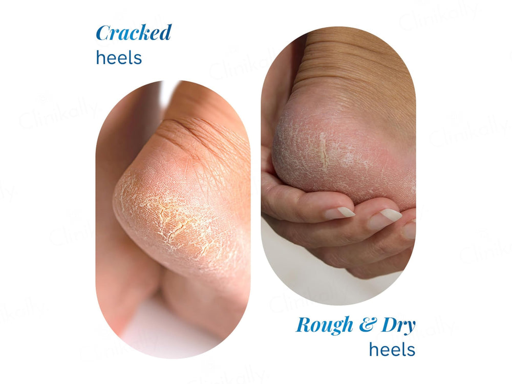 Be Bodywise 20% Urea Foot Roll On