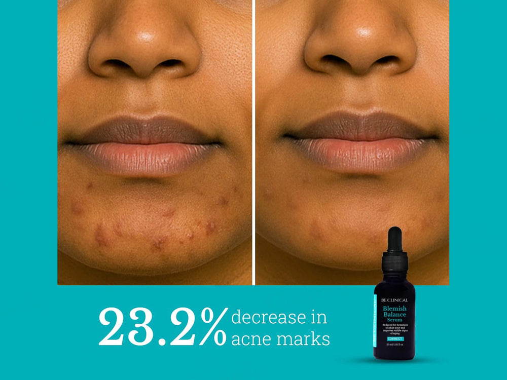 Be Clinical Blemish Balance Serum
