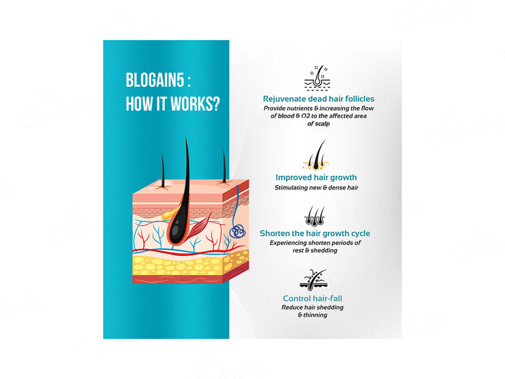 Blogain-5 Hair Growth Topical Solution