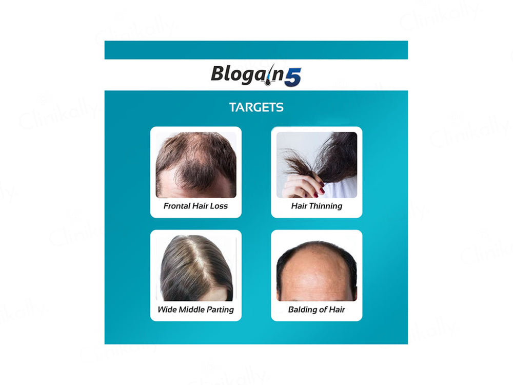 Blogain-5 Hair Growth Topical Solution