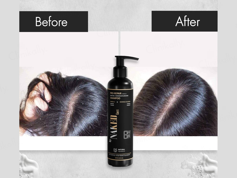 By Naked Fact Pro Repair Black Soil + Nardostachys Jatamansi Anti-Hairfall Shampoo