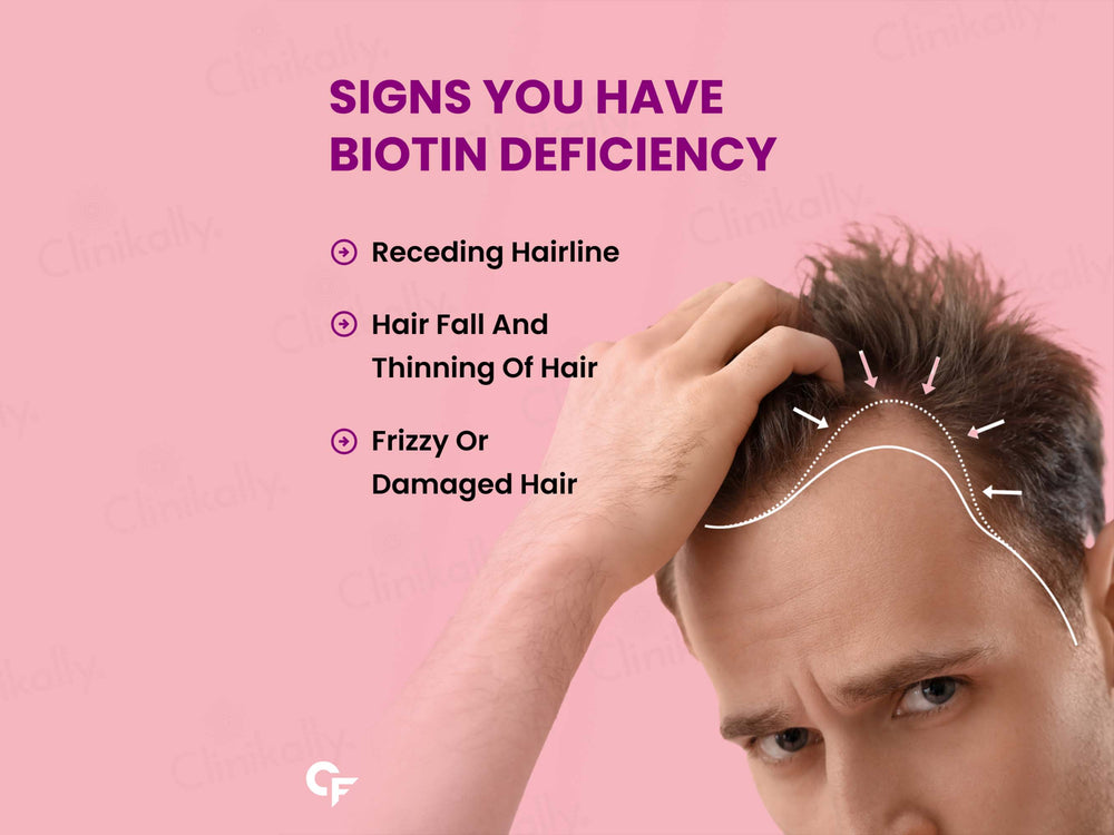 Carbamide Forte Biotin 10000mcg Tablet