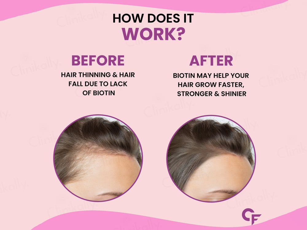 Carbamide Forte Biotin+ with 50 Multivitamin+ Tablet