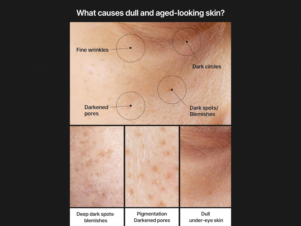 Celimax Pore + Dark Spot Brightening Cream