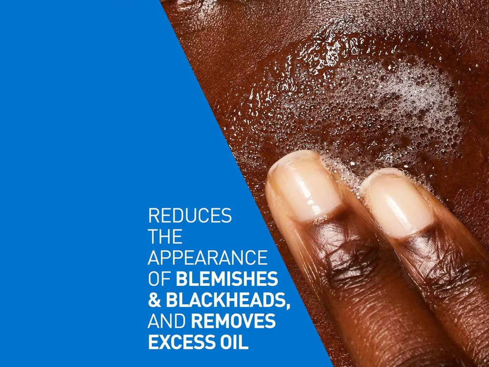 CeraVe Blemish Control Cleanser For Blemish-Prone Skin