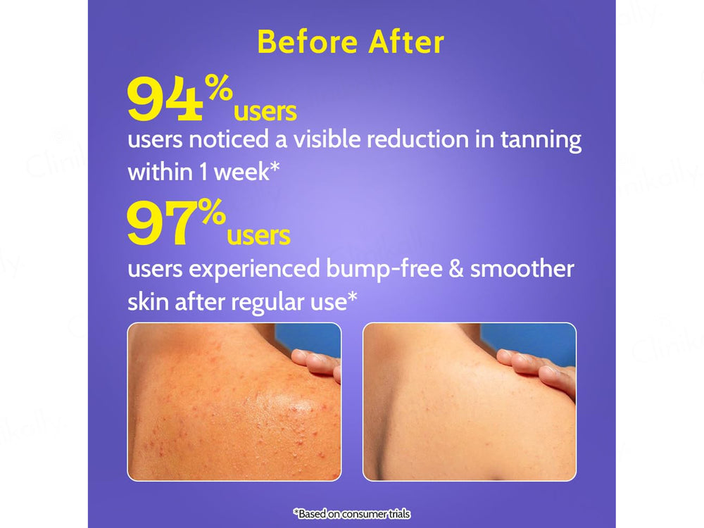 Chemist At Play 4% Daily Exfoliating Body Wash