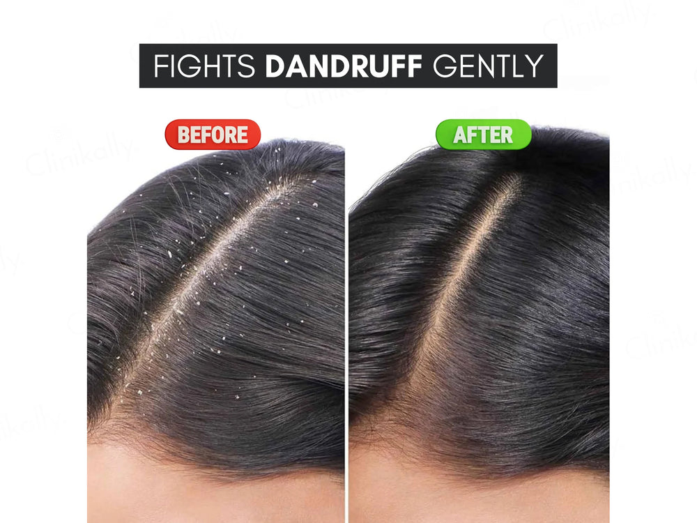 Climdruff Anti Dandruff Shampoo