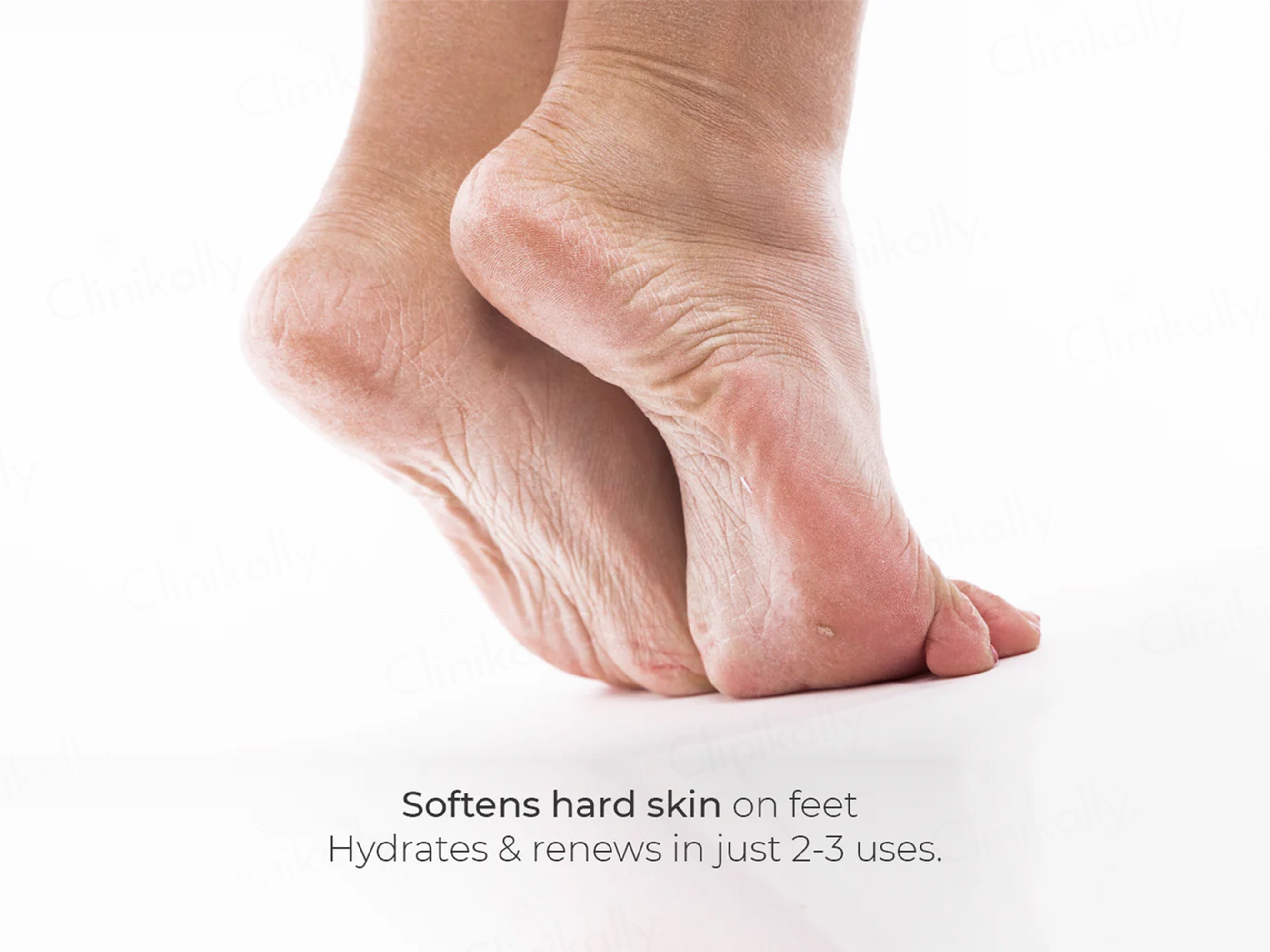 CodeSkin Velvet Foot Skin Softening Cream For Dry & Cracked Feet