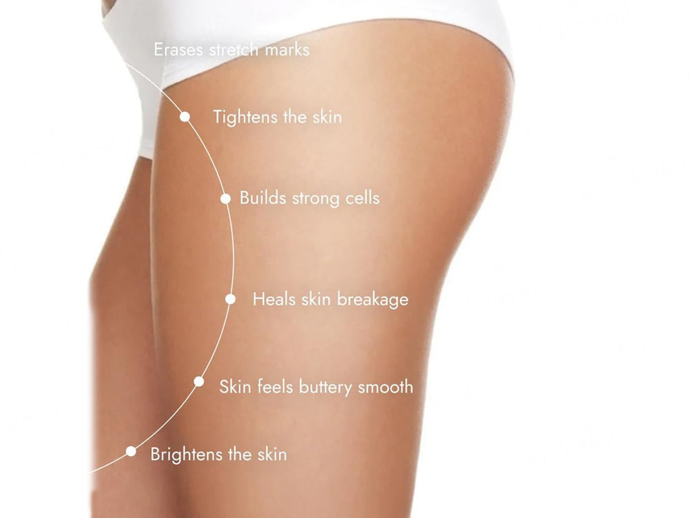 CosIQ Stretch Marks Removal Roll-On Serum With Striover