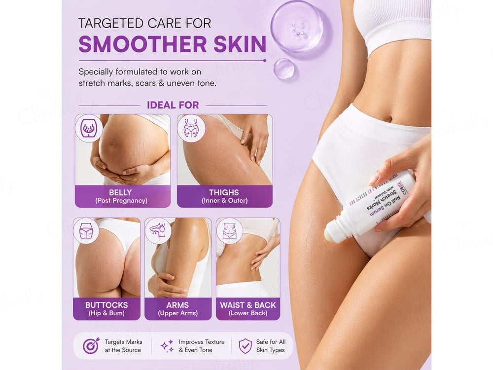 CosIQ Stretch Marks Removal Roll-On Serum With Striover
