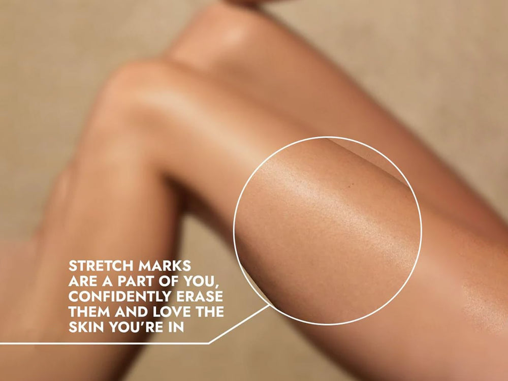 CosIQ Stretch Marks Removal Roll-On Serum With Striover