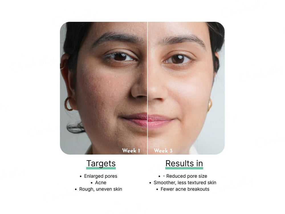 CosIQ Vitamin B3-5% Niacinamide Face Serum