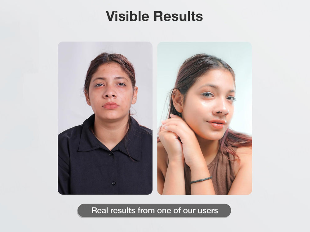 CosIQ Vitamin B3-5% Niacinamide Face Wash