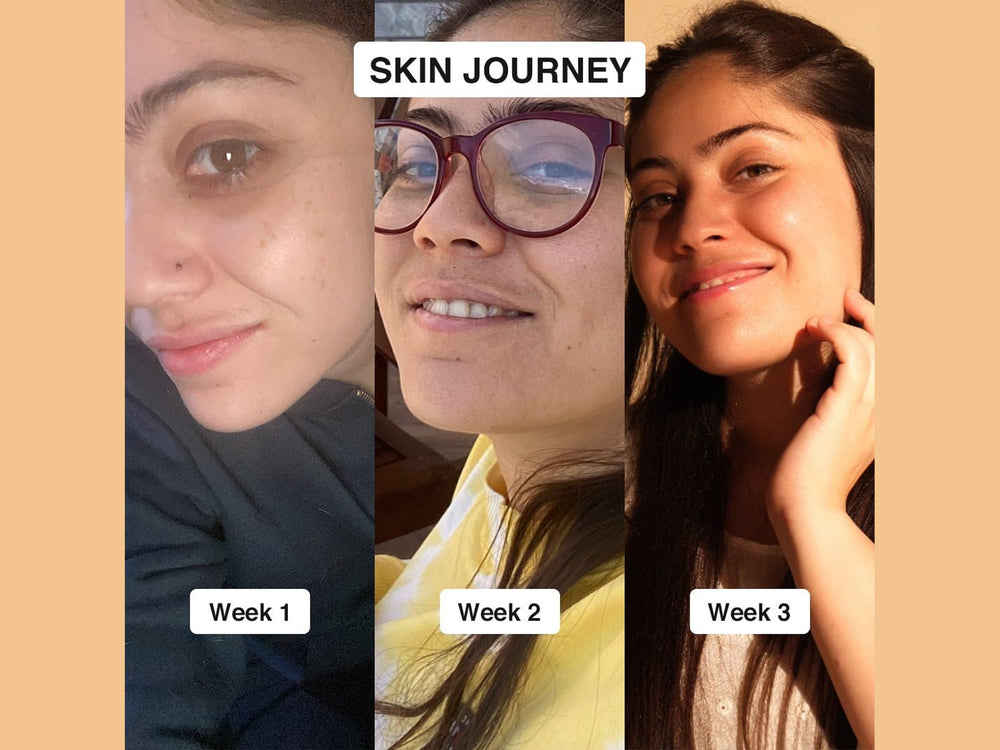 CosIQ Vitamin C-23% Ethylated Ascorbic Acid Face Serum