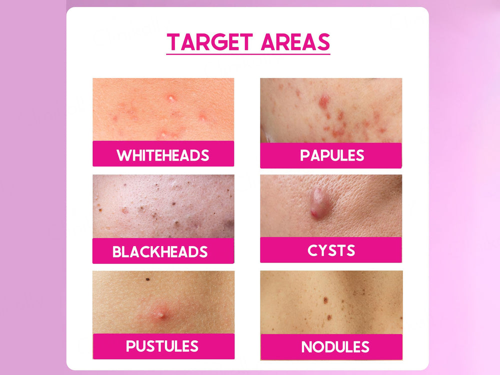 CosiQ ABP-33% AHA + BHA + PHA Strong Exfoliating Peeling Solution