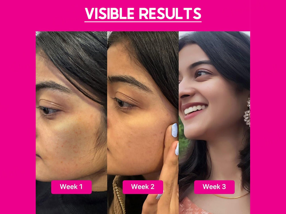 CosiQ ABP-33% AHA + BHA + PHA Strong Exfoliating Peeling Solution