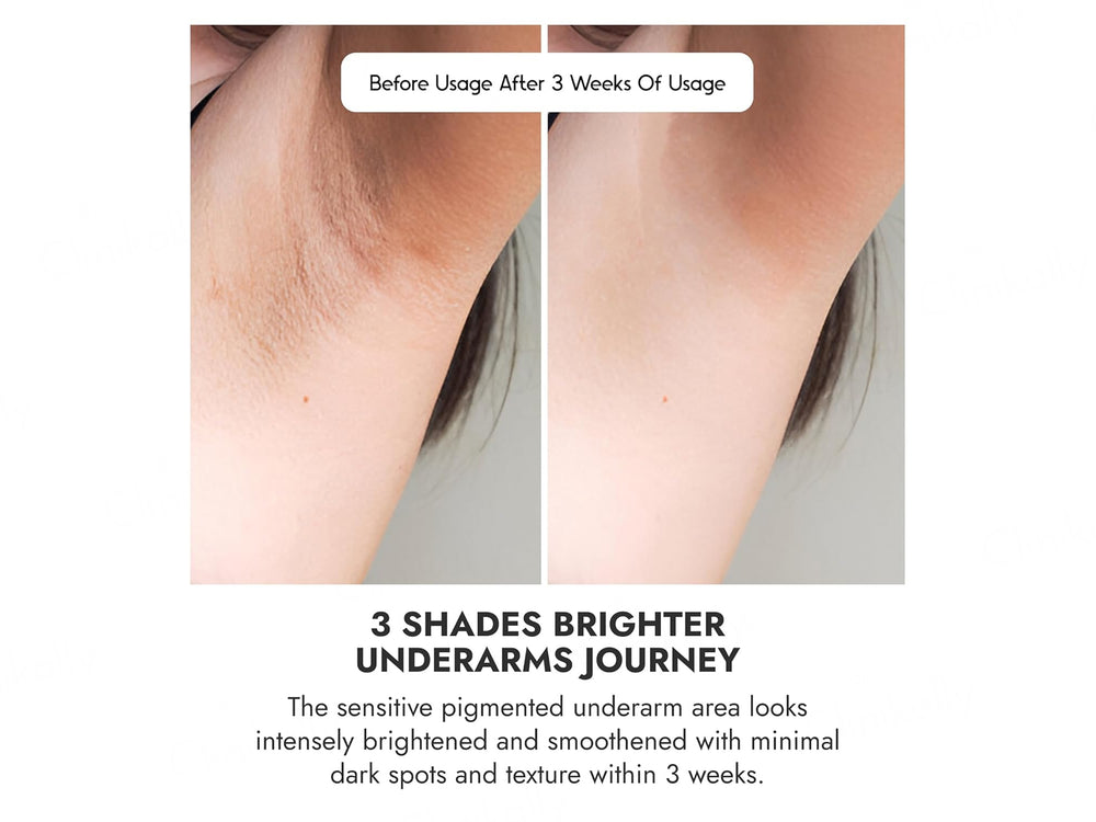 CosiQ Underarm Roll-On Serum For Women