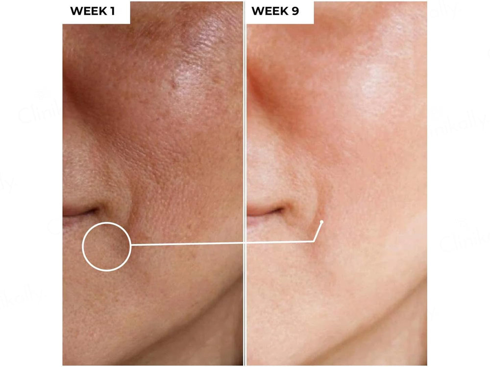 Dermabay 15% Vitamin C + 1% Hyaluronic Acid Face Serum