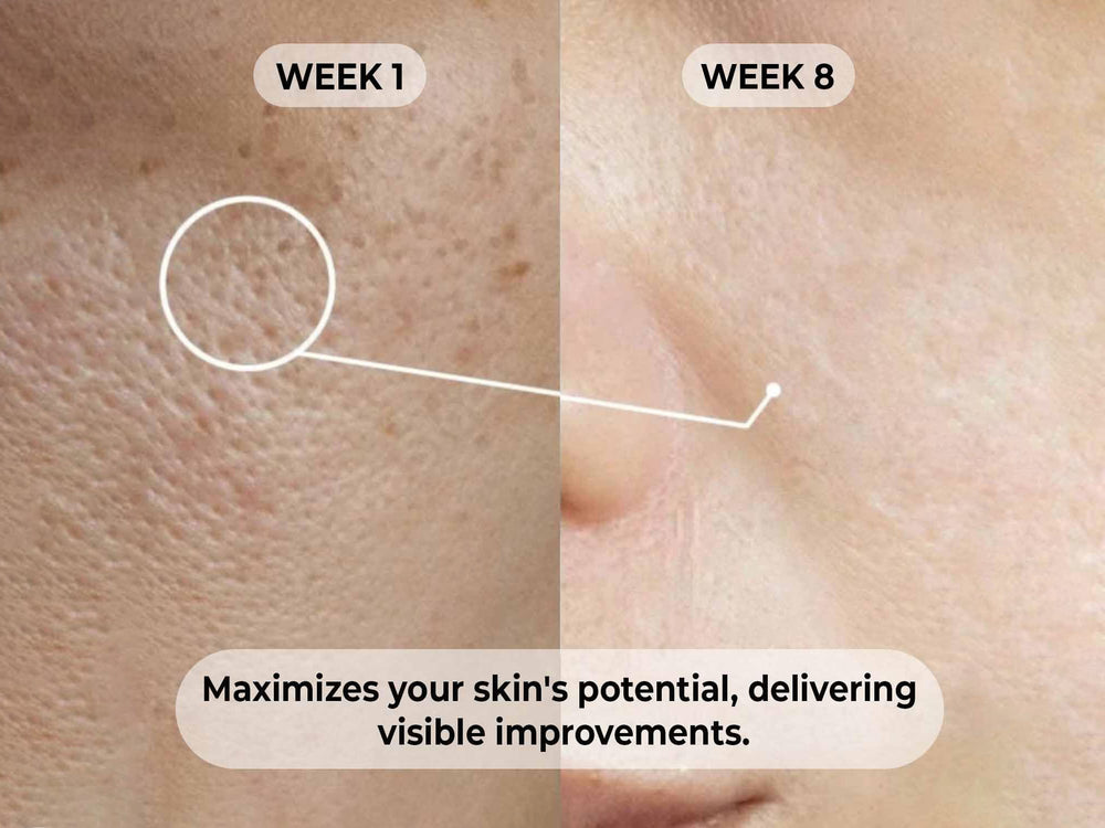 Dermabay 5% Niacinamide + 1% Hyaluronic Acid Face Serum