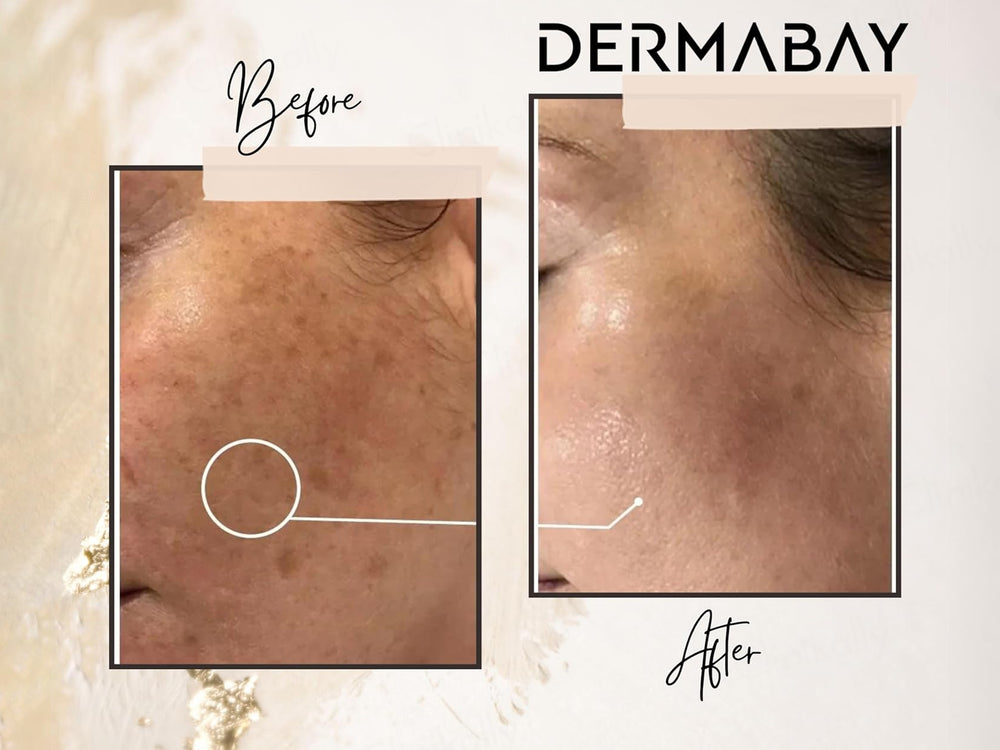 Dermabay Brightening Face Serum