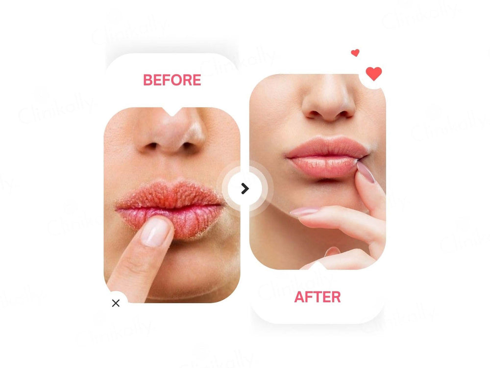 Dermina Ultra Hydrating Brightening Lip Balm