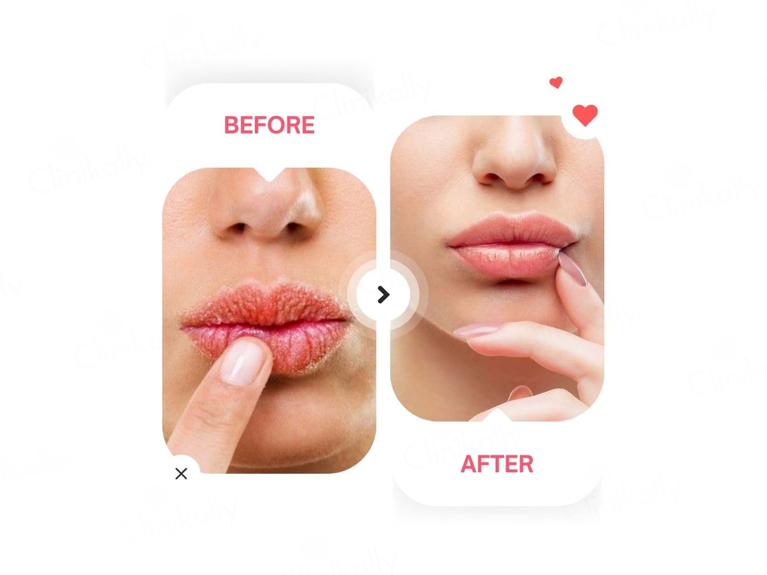 Dermina Ultra Hydrating Brightening Lip Balm