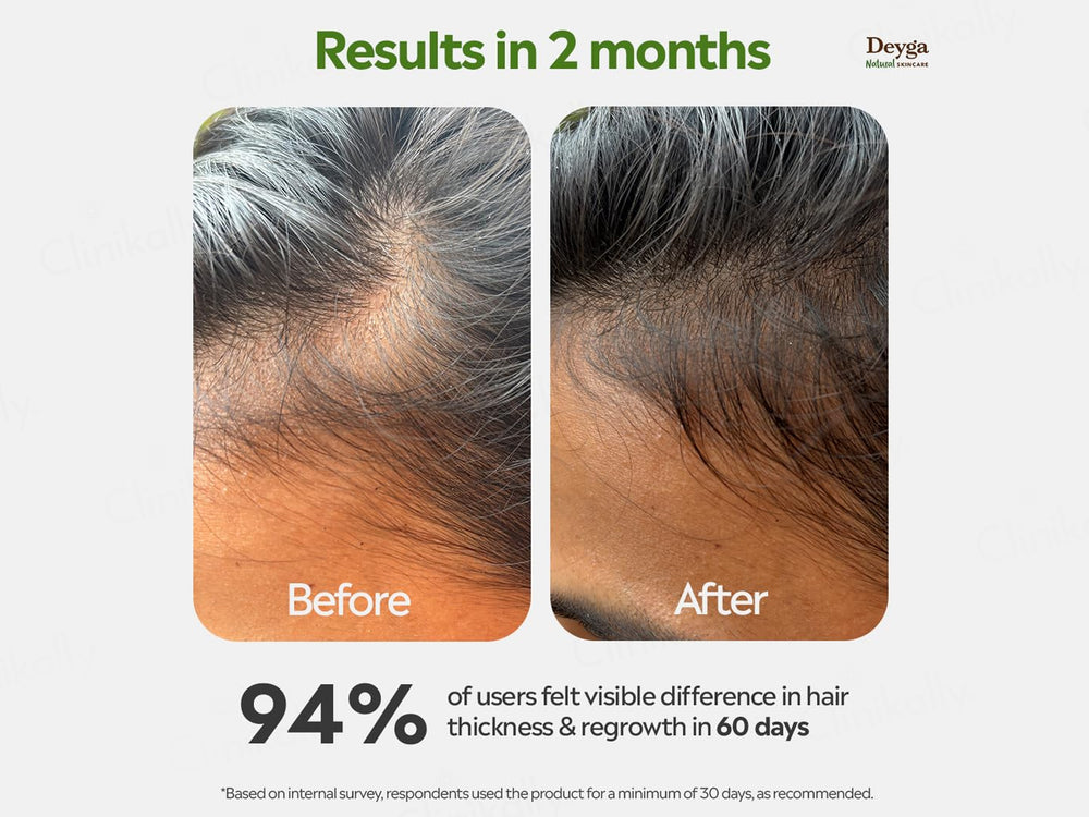 Deyga Hair Growth Oil
