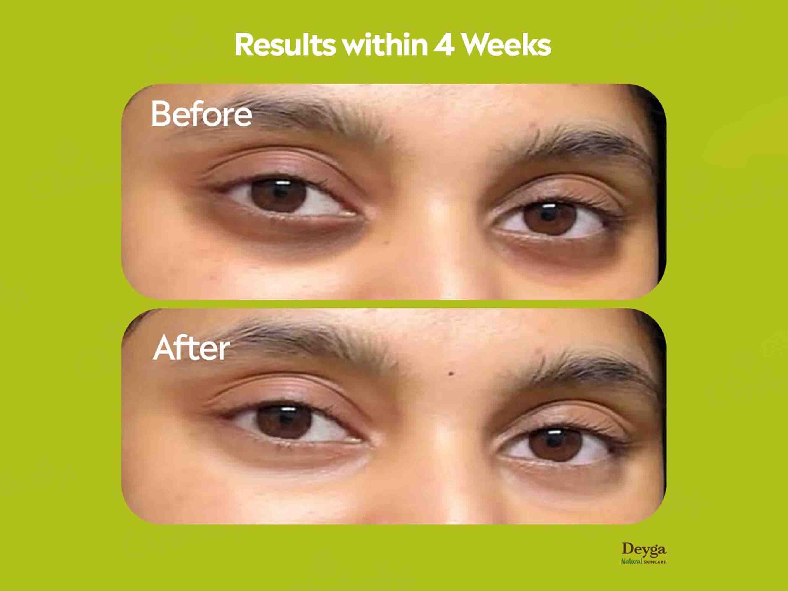 Deyga Under Eye Cream