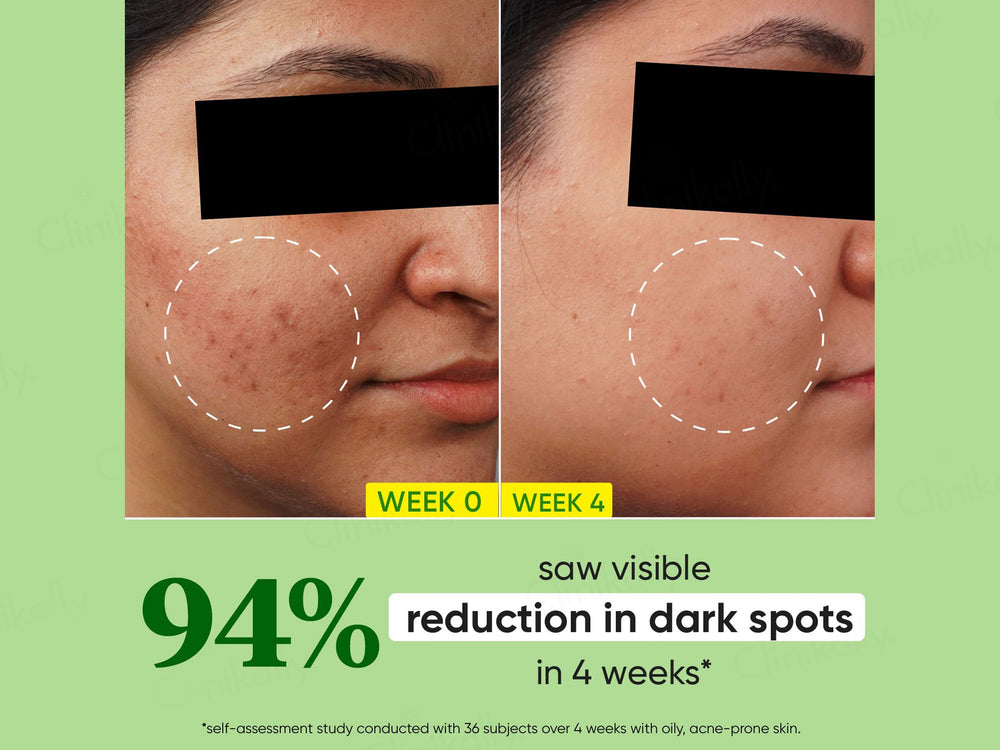 Dot & Key Cica + 10% Niacinamide Spot Reduction Face Serum