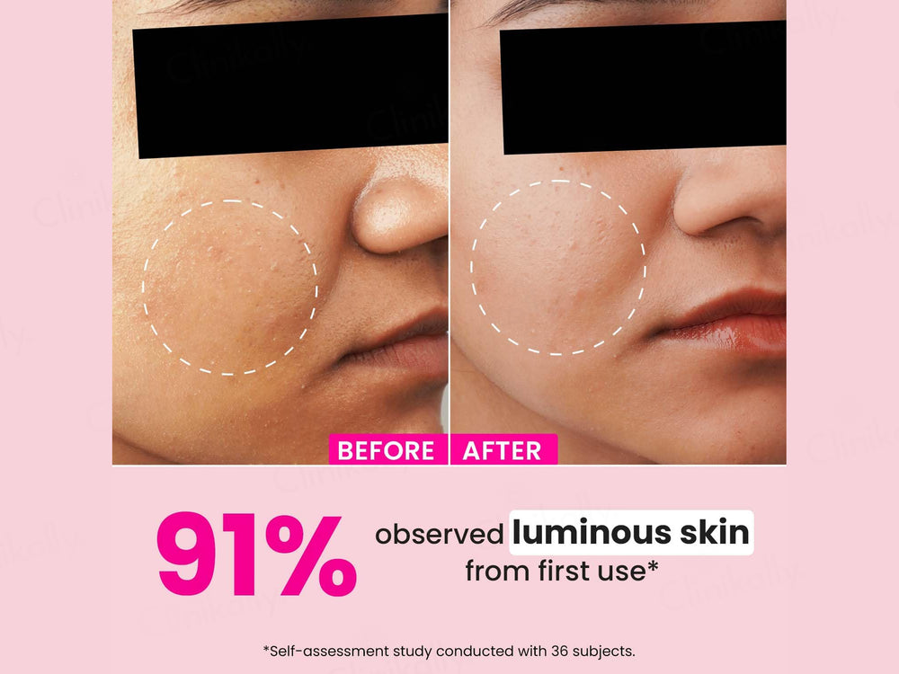 Dot & Key Watermelon + 10% Glycolic Gentle Exfoliating Face Serum