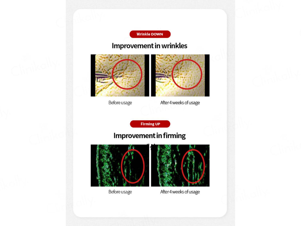 Dr. Different Vitalift-A Night Cream