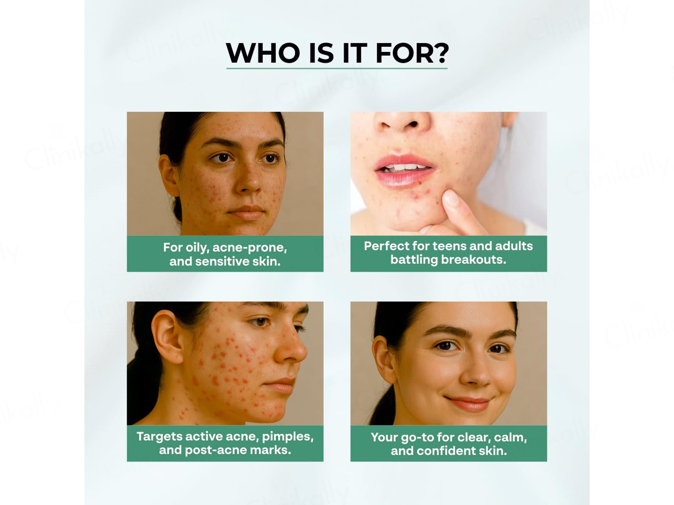 Dr. Sakhiya’s Acne & Pimple Moisturizer