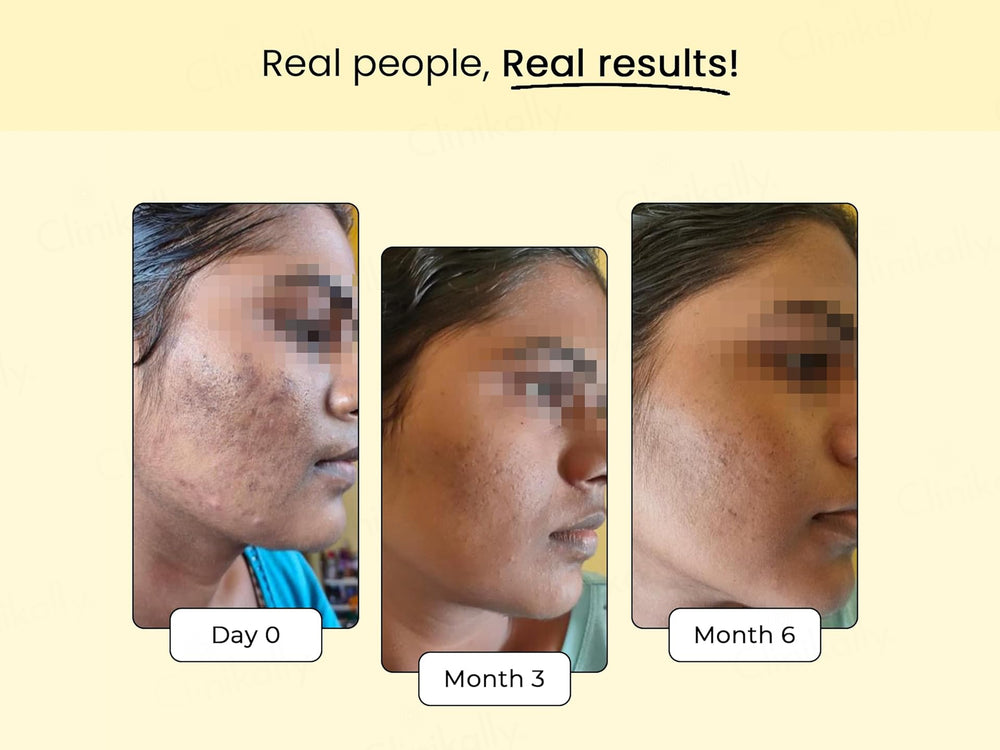 Dr. Su Gluta Glow Advanced Formula Tablet