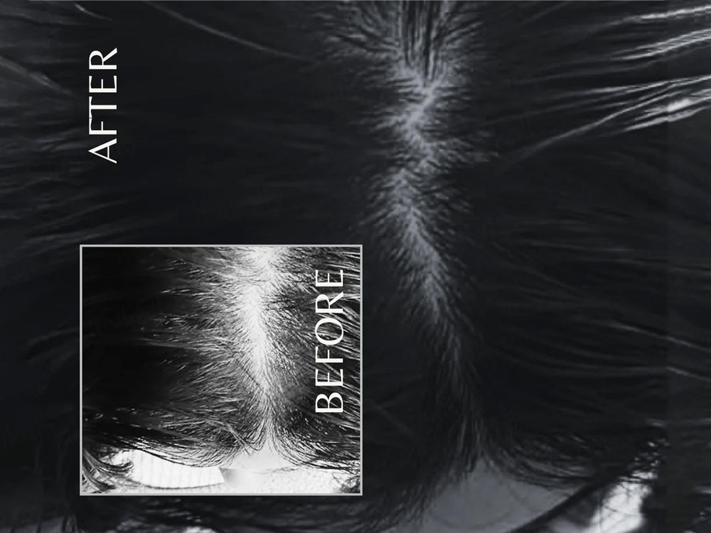 EnagenBio Octapep Hair Growth Scalp Serum