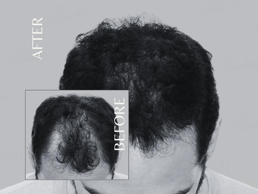 EnagenBio Octapep Hair Growth Scalp Serum