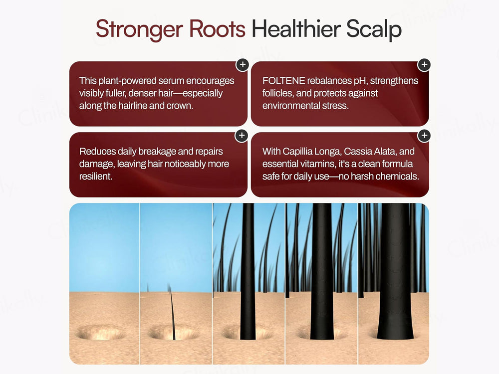 Foltene Pharma Hair & Scalp Treatment for Men