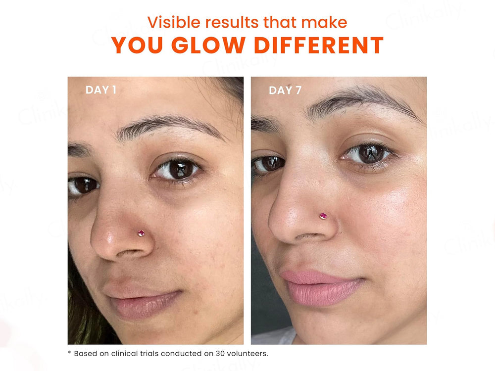 Foxtale Dewy Water-Resistant Sunscreen SPF 70 PA++++