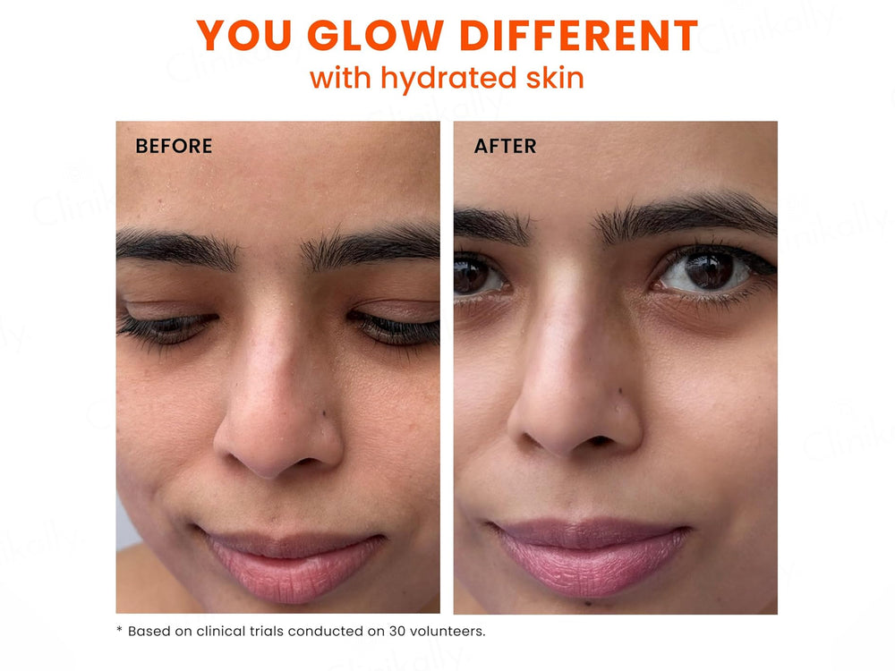 Foxtale Nourishing Moisturizer