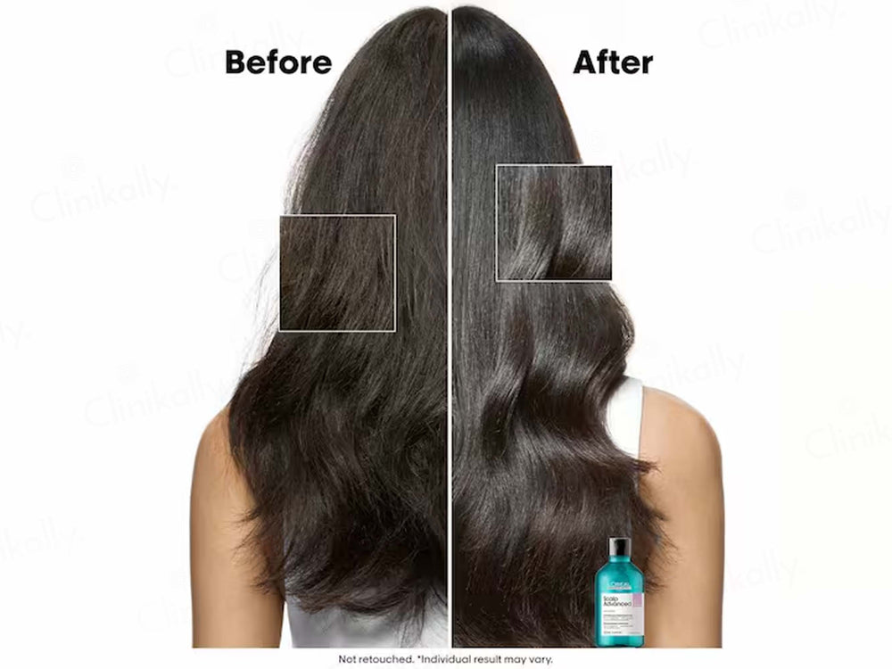 L'Oréal Professionnel Scalp Advanced Anti-Discomfort Dermo-Regulator Shampoo